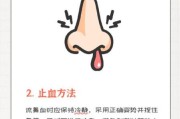 高原流鼻血严重吗_如何预防高原流鼻血