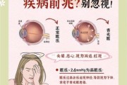 高原眼压高怎么办_高原反应眼压升高原因