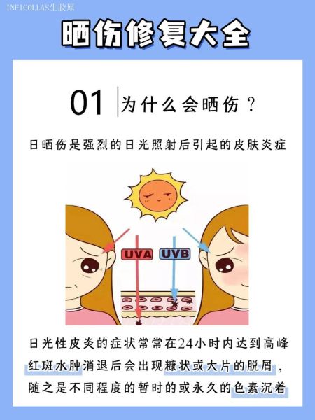 高原晒伤怎么办_高原晒伤多久恢复