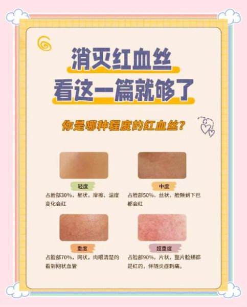 康定会出现高原红吗_康定高原红预防方法