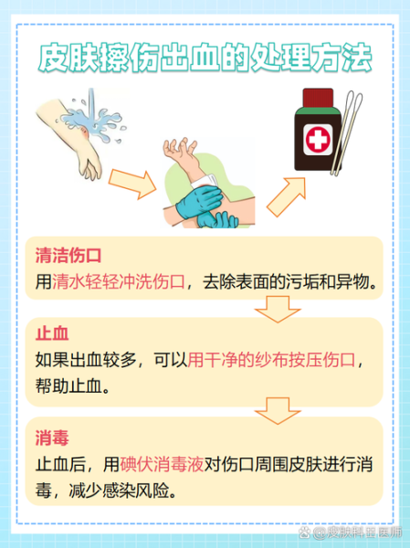 户外出血怎么办_野外止血急救步骤