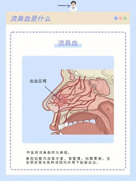 高原流鼻血怎么办_高原旅游流鼻血急救方法