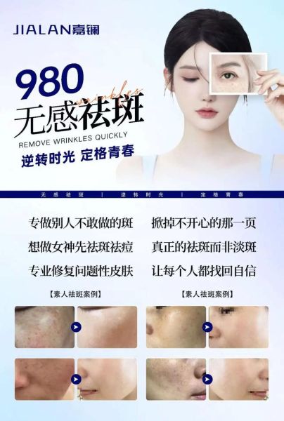 高原红怎么消除_高原红用什么护肤品