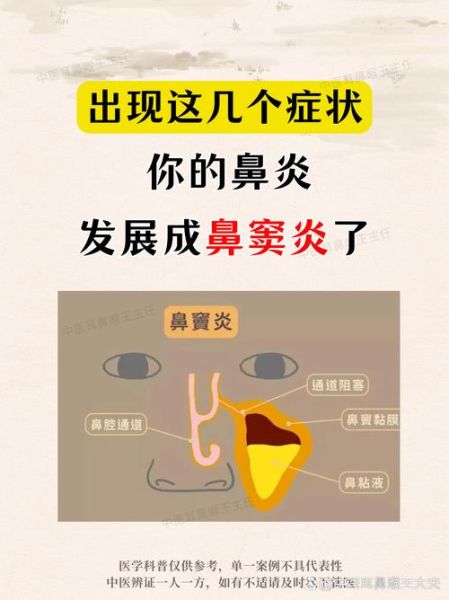 鼻炎能上高原吗_高原反应会加重鼻炎吗