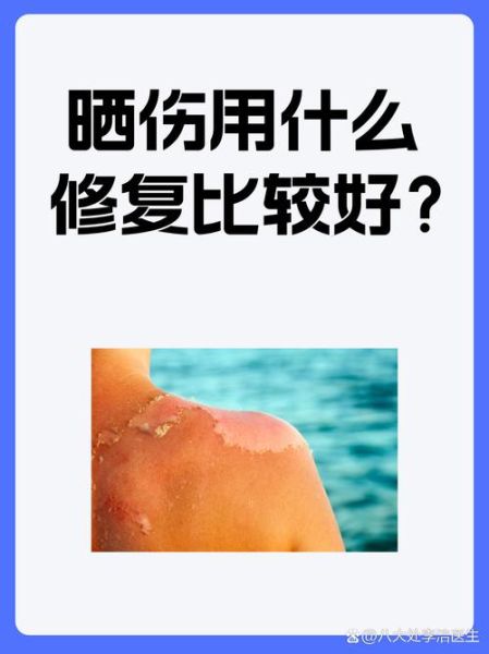 高原晒伤后怎么快速修复_高原晒伤多久能好