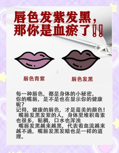 高原反应嘴唇发紫怎么办_高原反应嘴唇发紫严重吗
