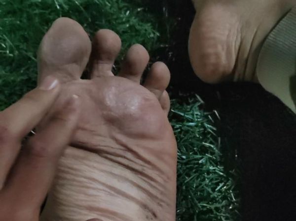 赤脚户外_脚底会不会受伤